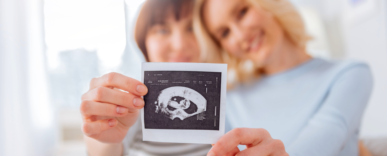 Reciprocal IVF, everything you need to know. 