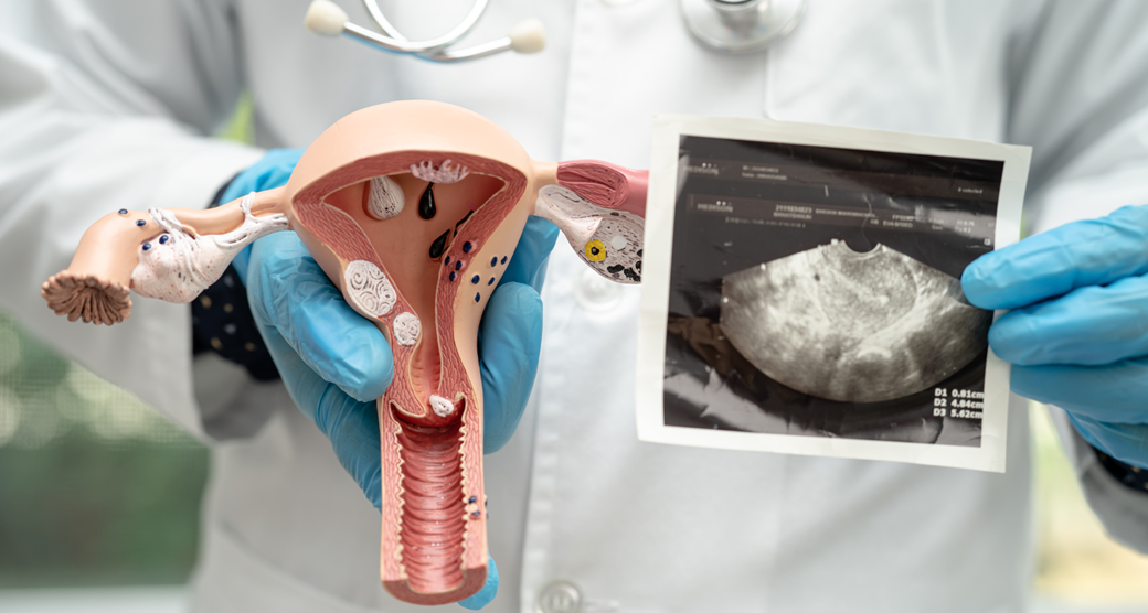 Understanding Ectopic pregnancy and IVF : abc ivf 