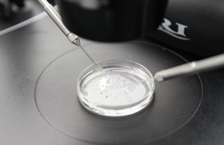 Egg Sperm Fertilisation