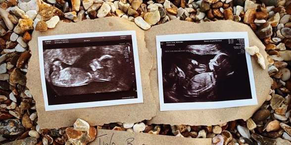 Kerry and Emily's Story